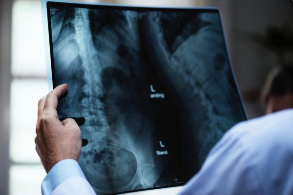 doctor looking at an xray - what is travel insurance?